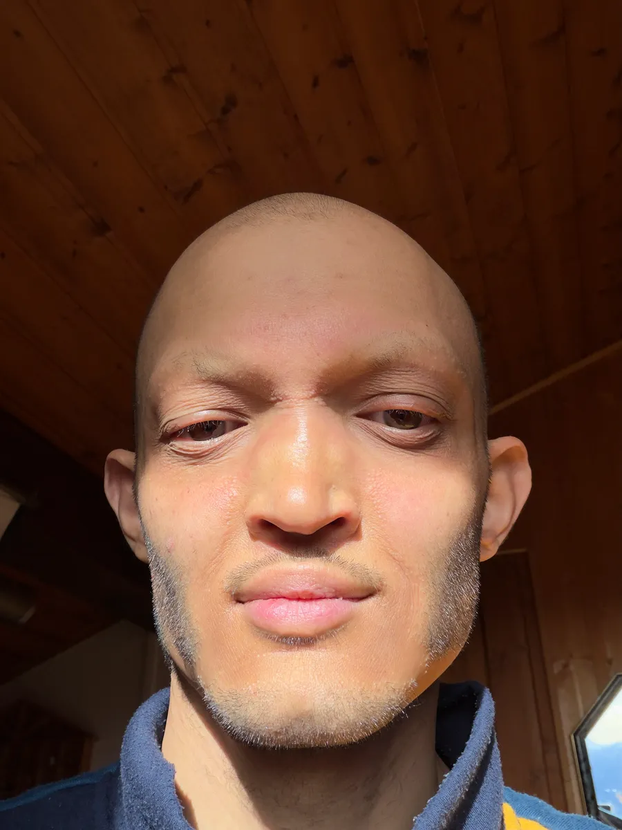 Phone selfie under hard sunlight, navy fleece with a yellow stripe, wooden ceiling